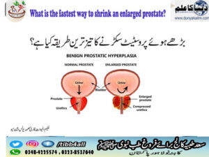 What is the fastest way to shrink an enlarged prostate?