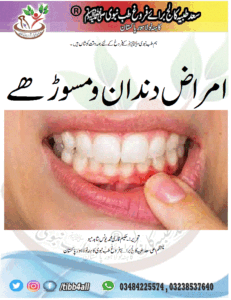 Read more about the article امراض دندان و مسوڑھے