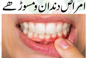 امراض دندان و مسوڑھے