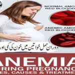 Anemia in pregnant women and its solution.