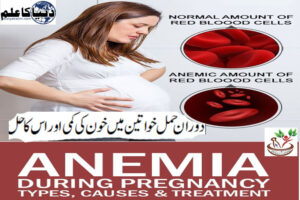 Read more about the article Anemia in pregnant women and its solution.