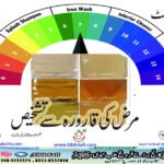 مرض کی قارورہ سے تشخیص