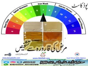 مرض کی قارورہ سے تشخیص