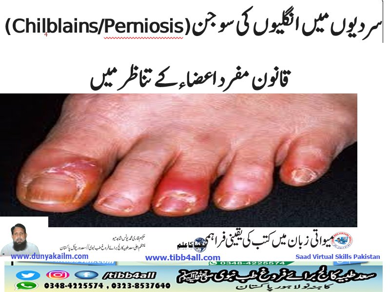 سردیوں میں انگلیوں کی سوجن