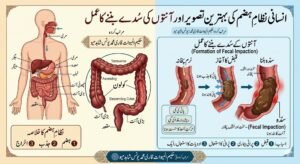 انسانی نظام ہضم میں سدے بننے کا عمل قانون مفرد اعضاء کے مطابق