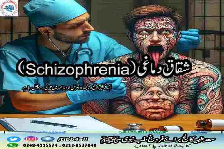 شقاق دماغی(Schizophrenia)